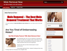 Tablet Screenshot of mole-removal-now.com